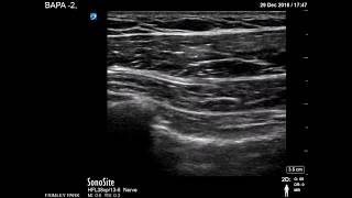 Pectoral muscles scanning [upl. by Clarisa59]