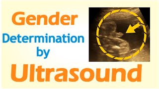 Gender Determination by Ultrasound [upl. by Clarine]